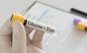 Doctor holding sample blood collection tube with glucose test label in the lab.