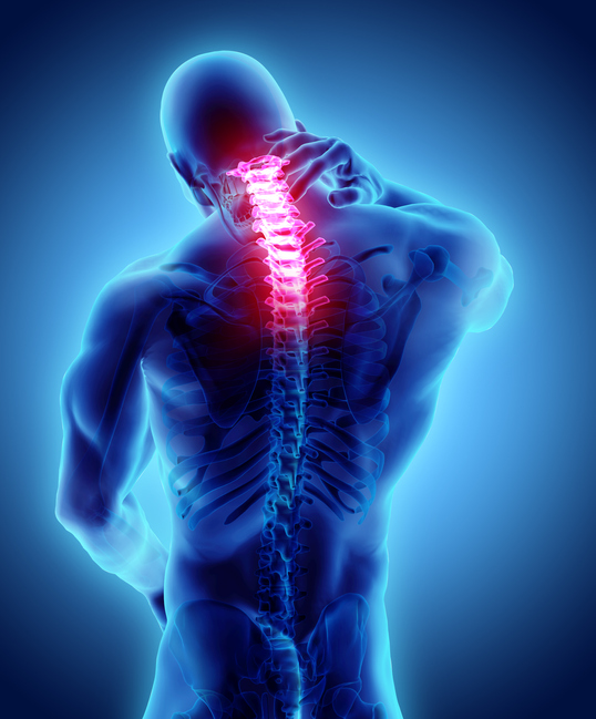 A 3D visualization of a person's spine, with the top half of the spine glowing red to indicate spinal cord compression.